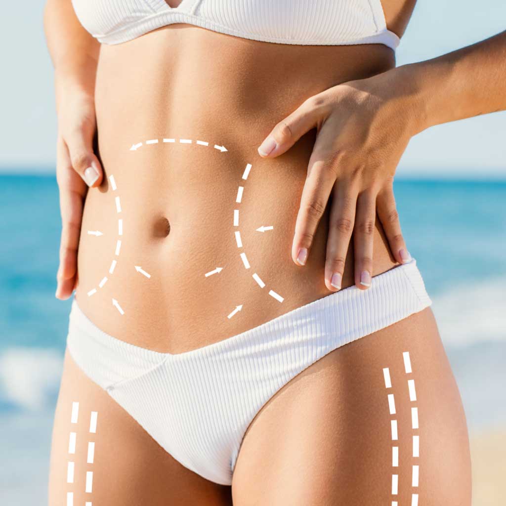 body-contouring