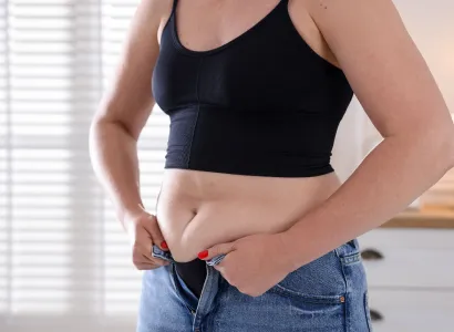 Liposuction-Assisted Body Lift