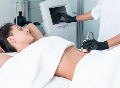 Intragastric Balloon