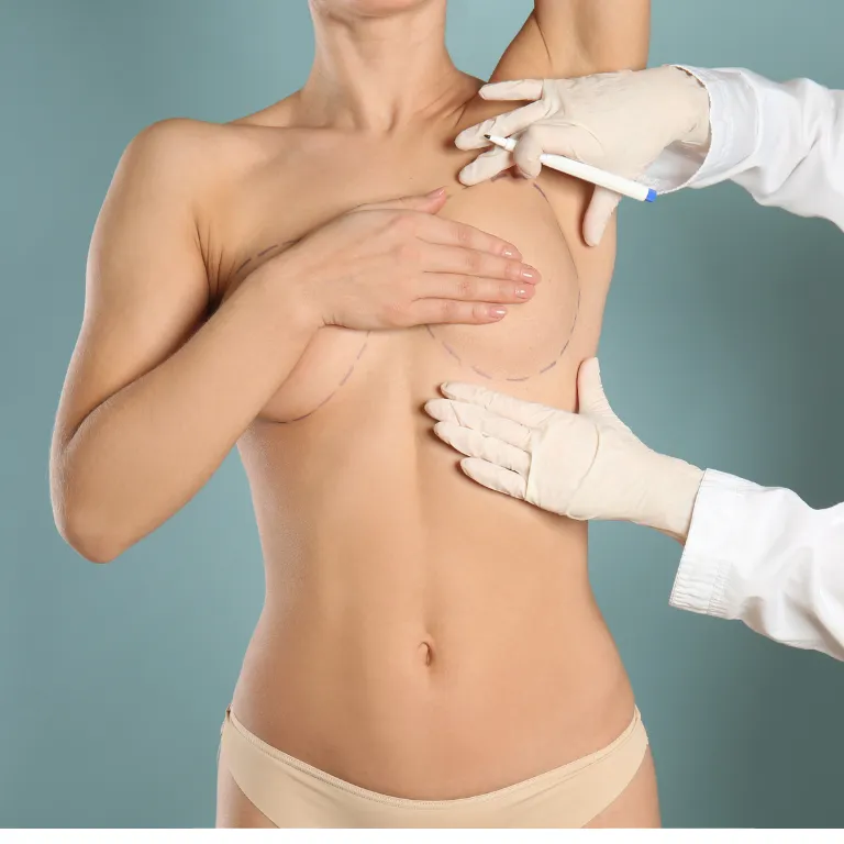 Breast Augmentation