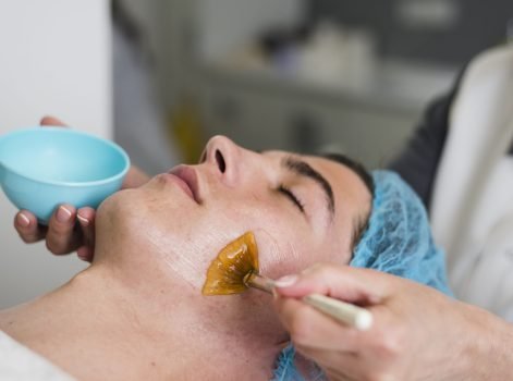 Chemical Peeling treatment in Delhi