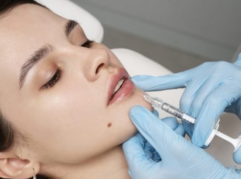 Dermal fillers treatment in Delh