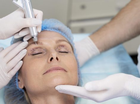 Upper Eyelid Surgery