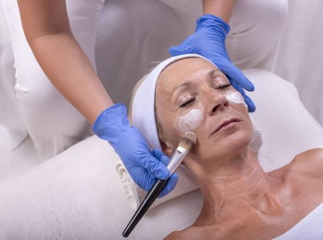 Chemical Peeling treatment in Delhi