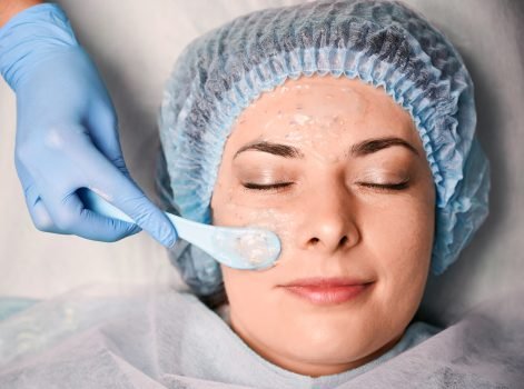 Pigmentation and Dark Spot Peels