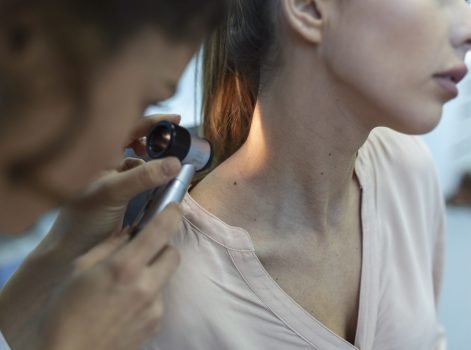 Mole & Skin Tag Removal Treatment in Delhi