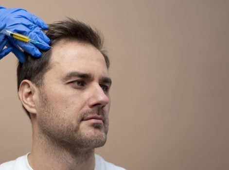 Hair Loss Treatment in Delhi