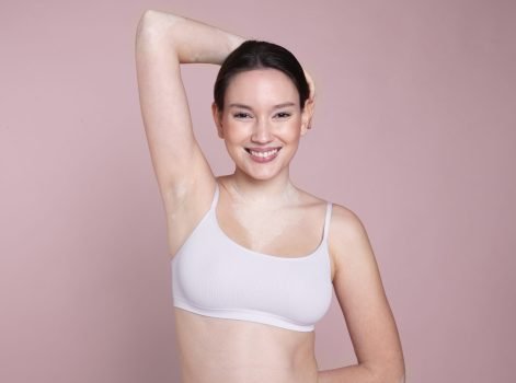 Laser Hair Reduction Treatment in Delhi