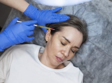 Hair Loss Treatment in Delhi