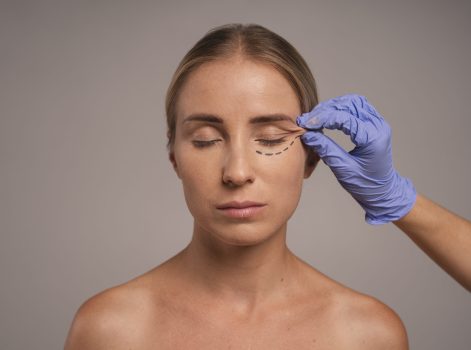 Lower Eyelid Surgery